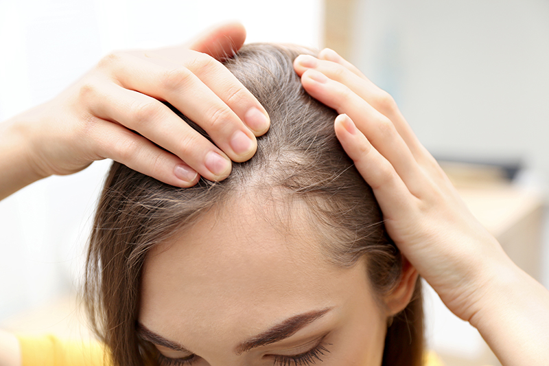 Hair Loss Prevention: Lifestyle, Diet, and Stress Management Tips