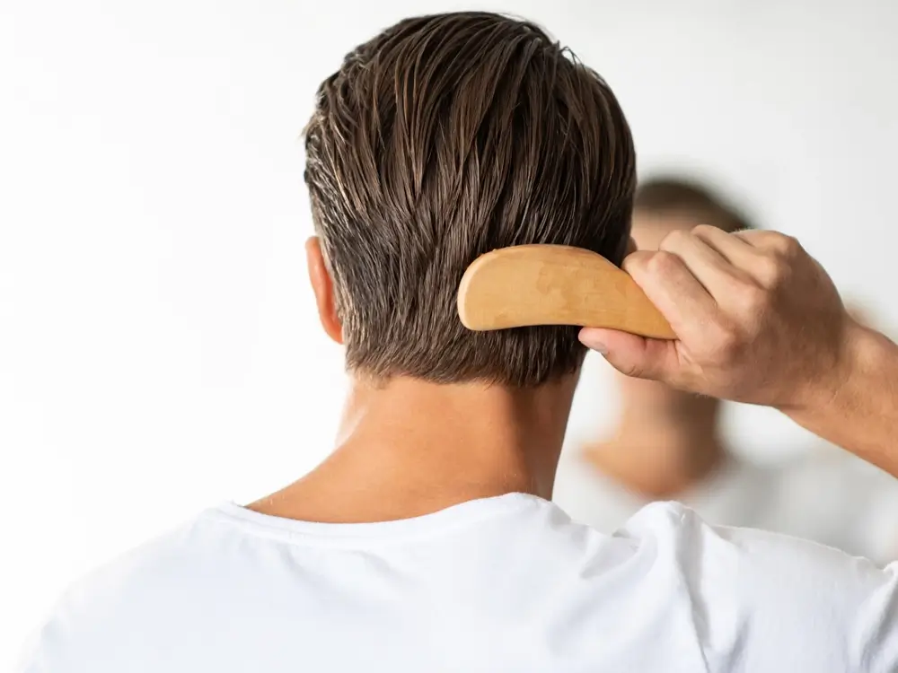 FUT Hair Transplant