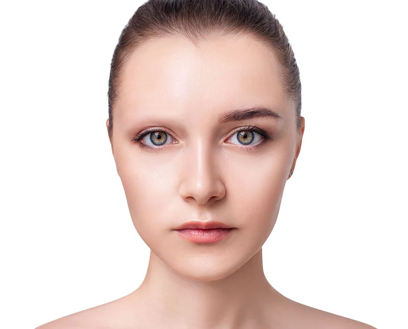 Young woman with bald eyebrows before and after hair transplantation