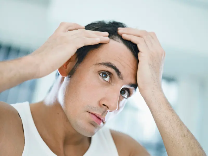 A man parts his hair with both hands to examine his scalp and hairline