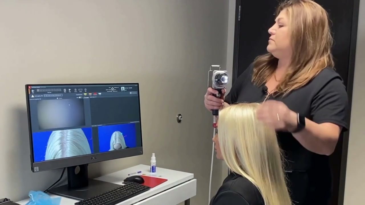 Evaluation and Consultation Process for Diagnosing Hair Loss