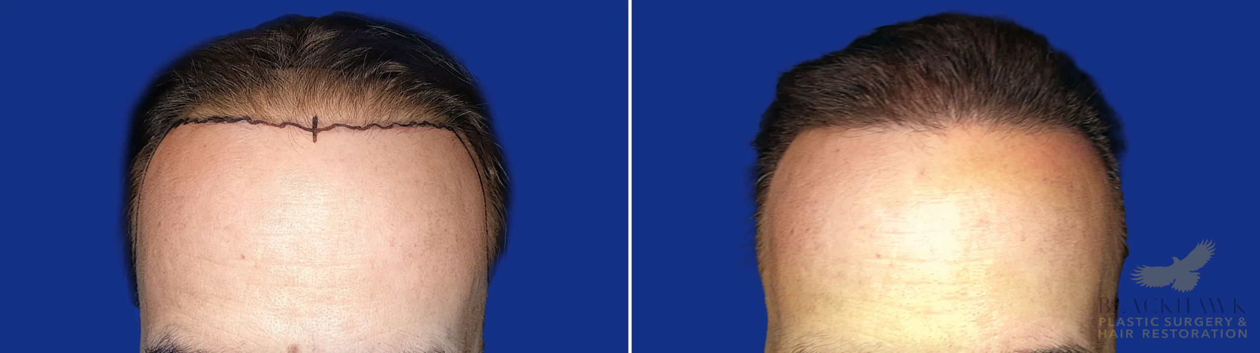 View • Before | After