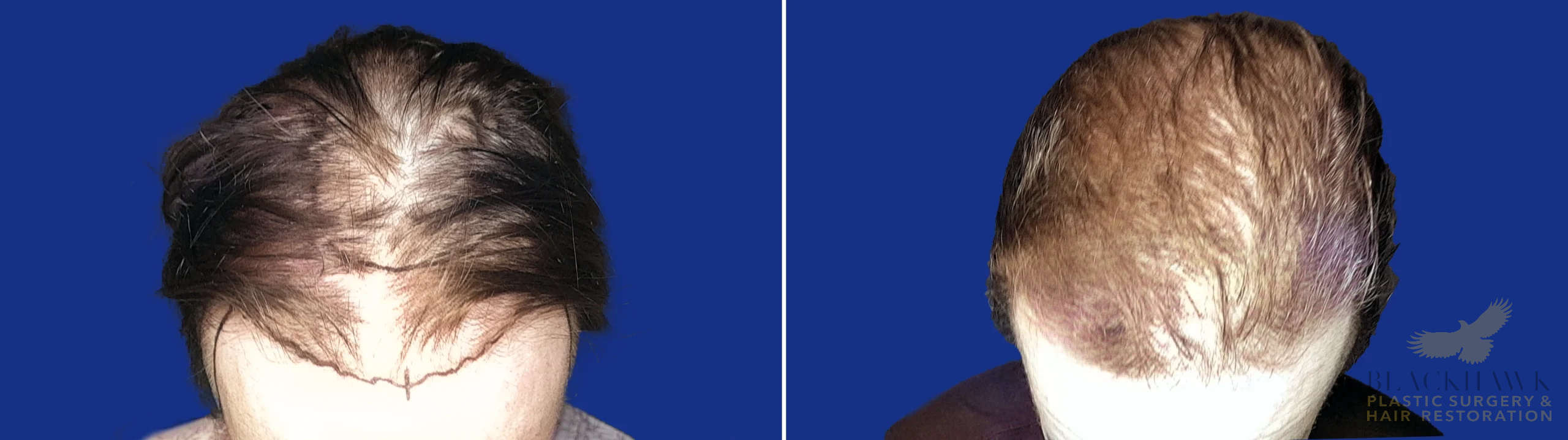 View • Before | After