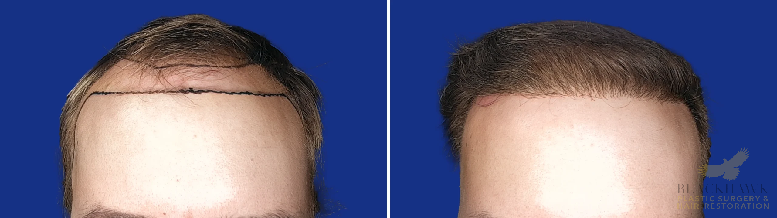 View • Before | After