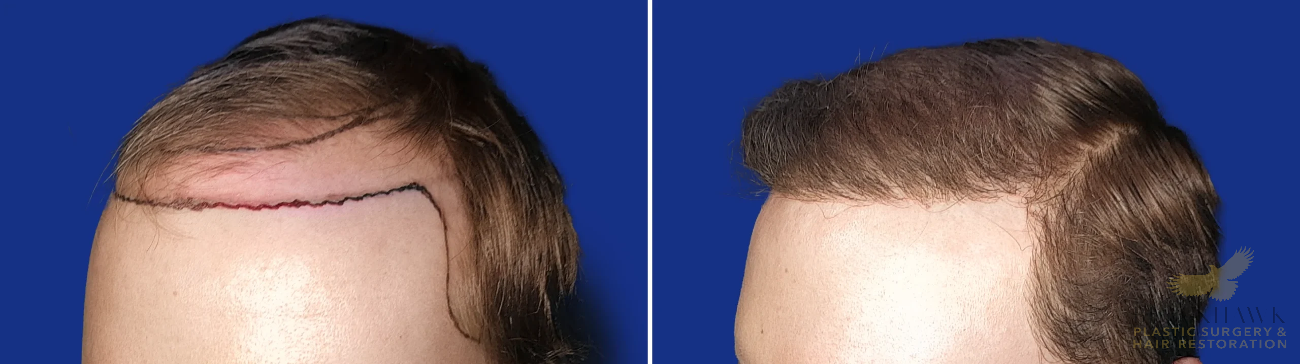 View • Before | After