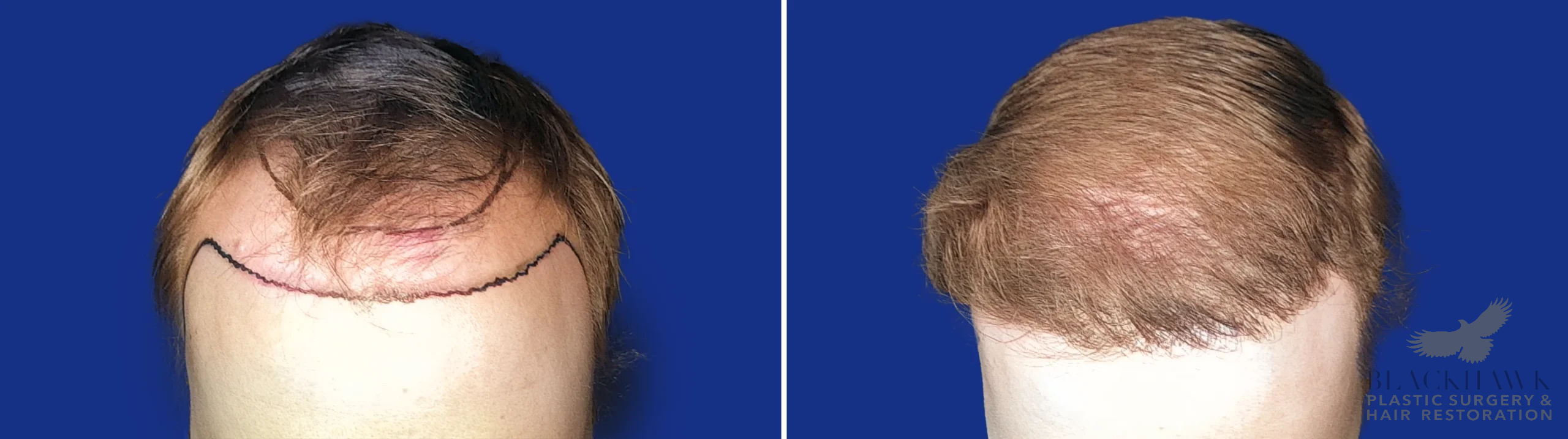 View • Before | After