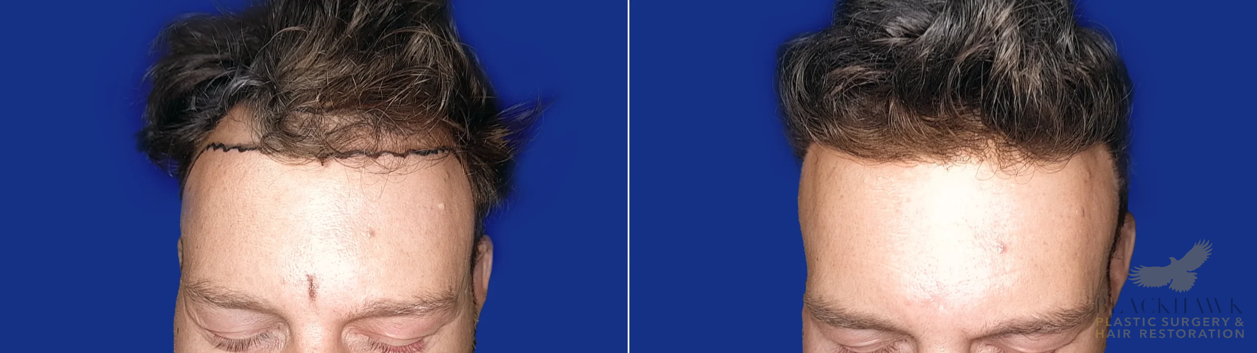 View • Before | After