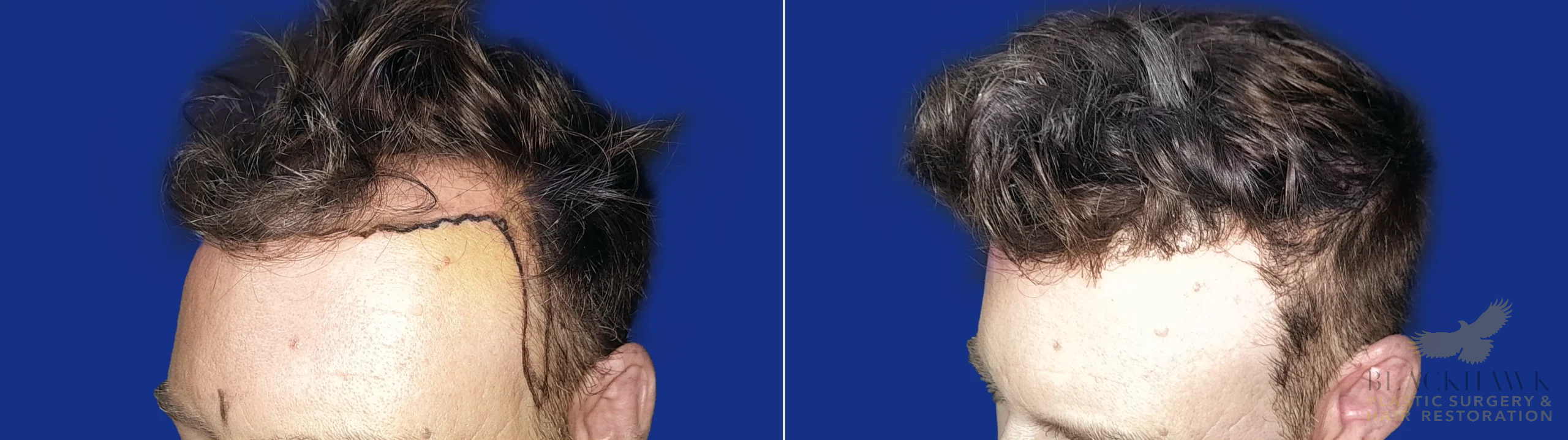 View • Before | After