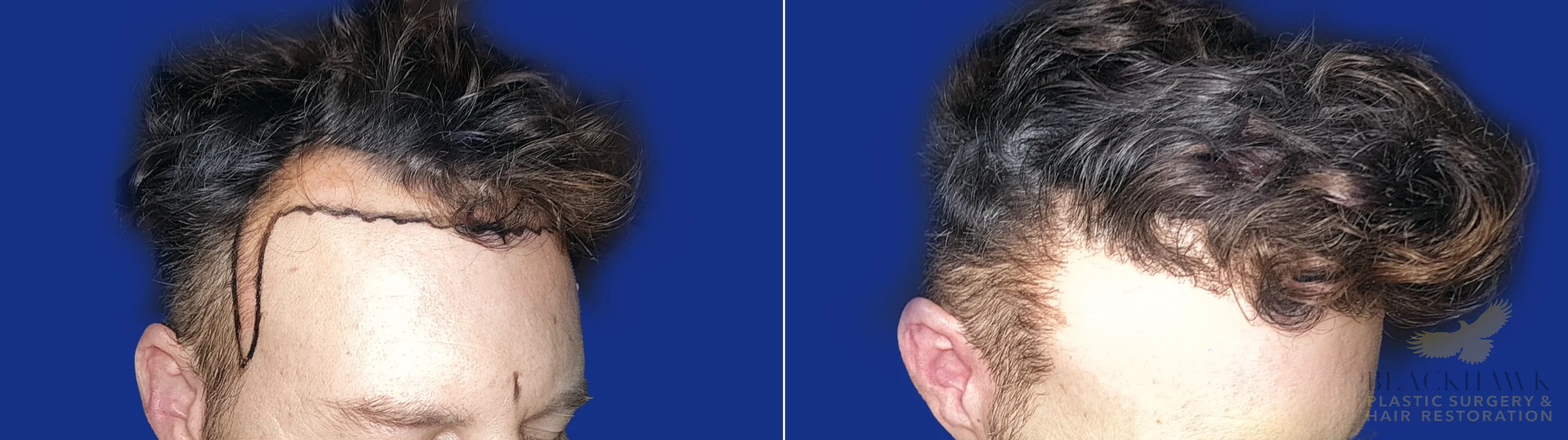 View • Before | After