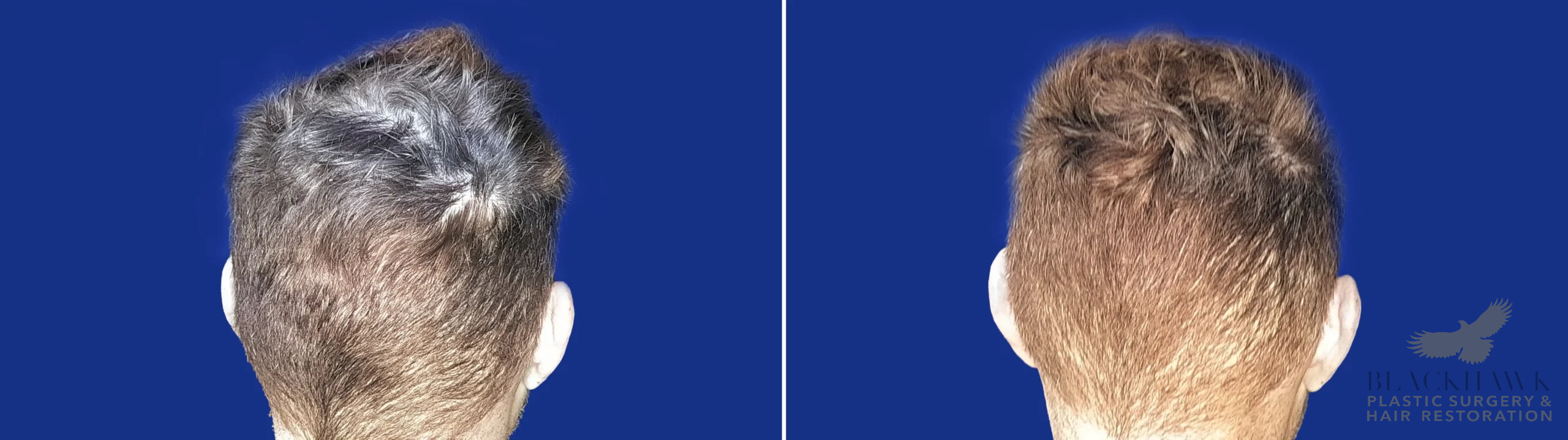 View • Before | After