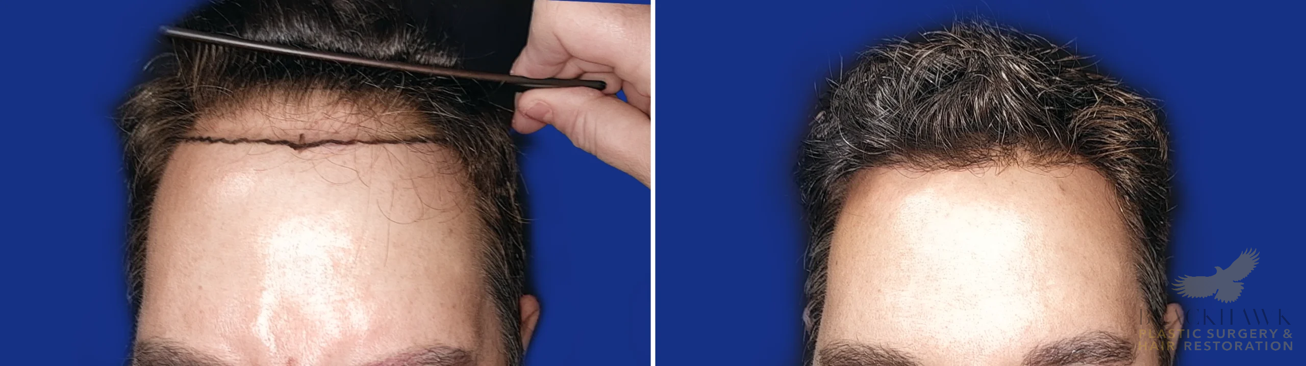 View • Before | After