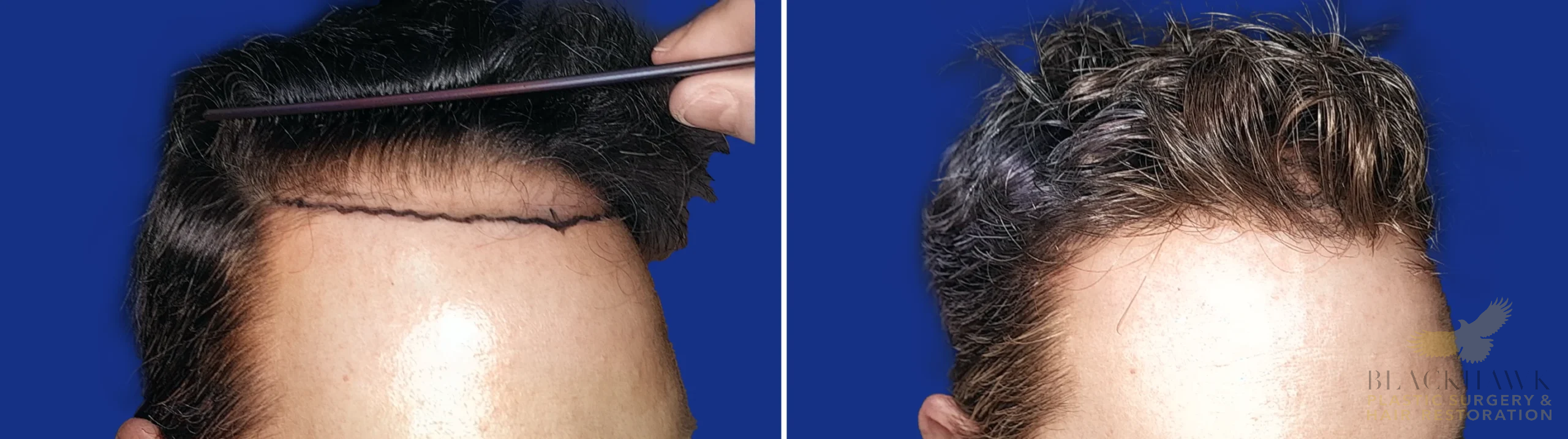 View • Before | After