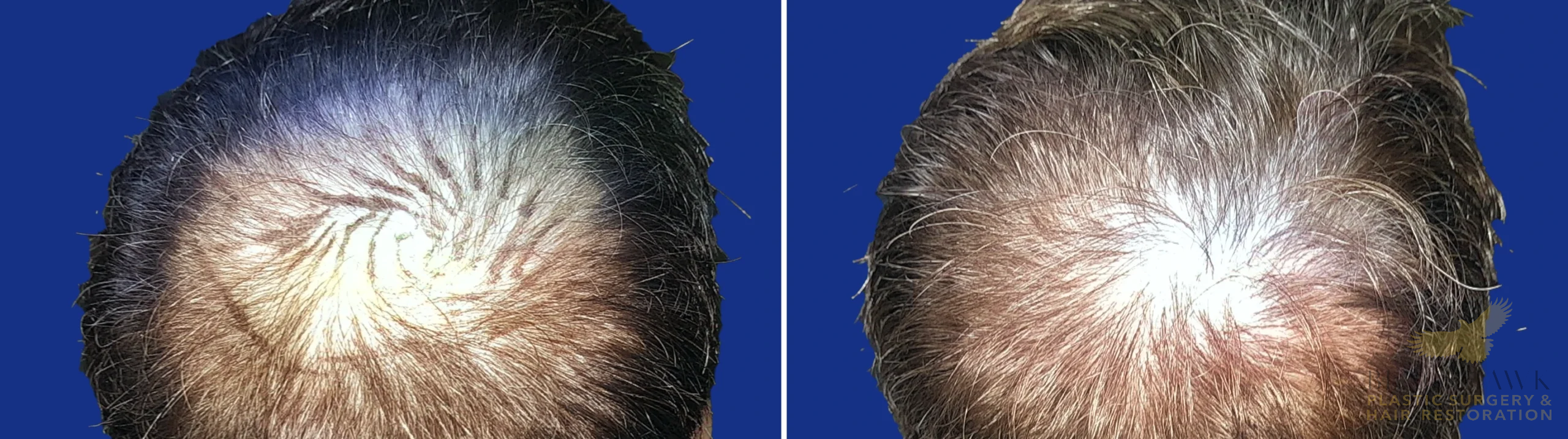 View • Before | After