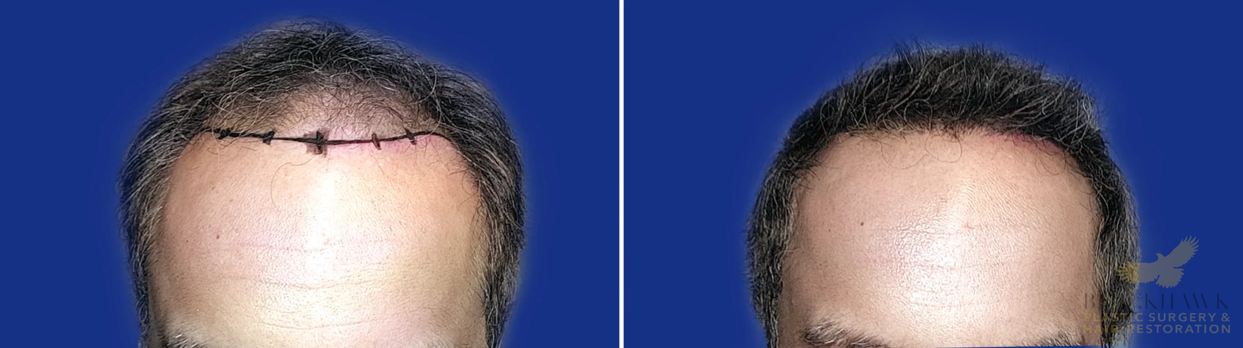 View • Before | After