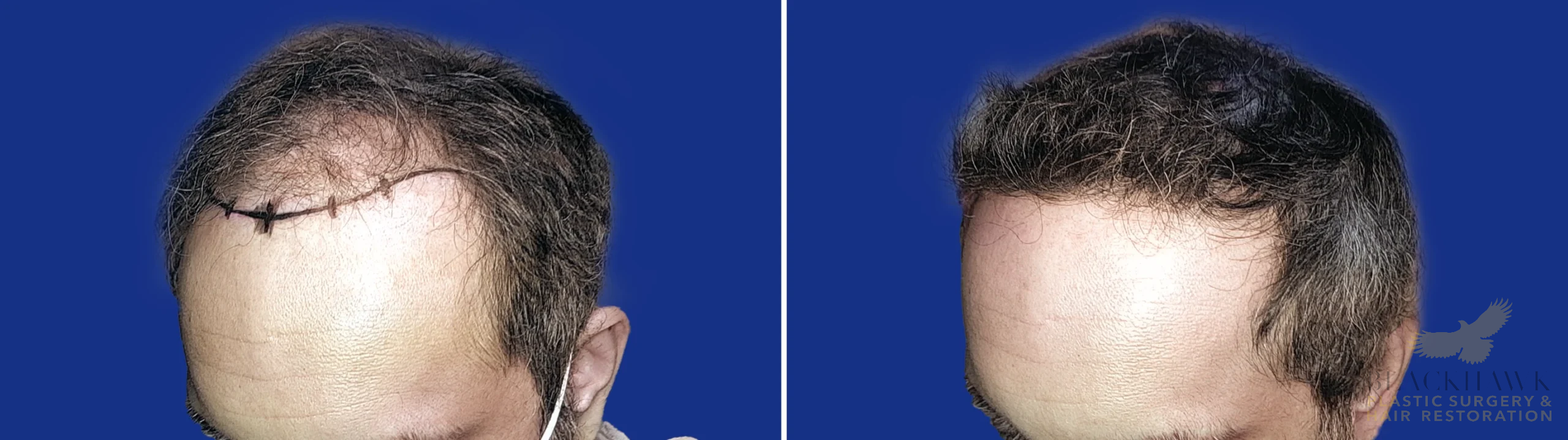 View • Before | After