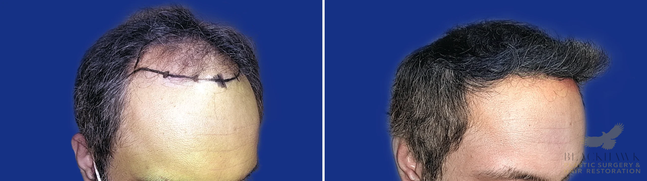 View • Before | After