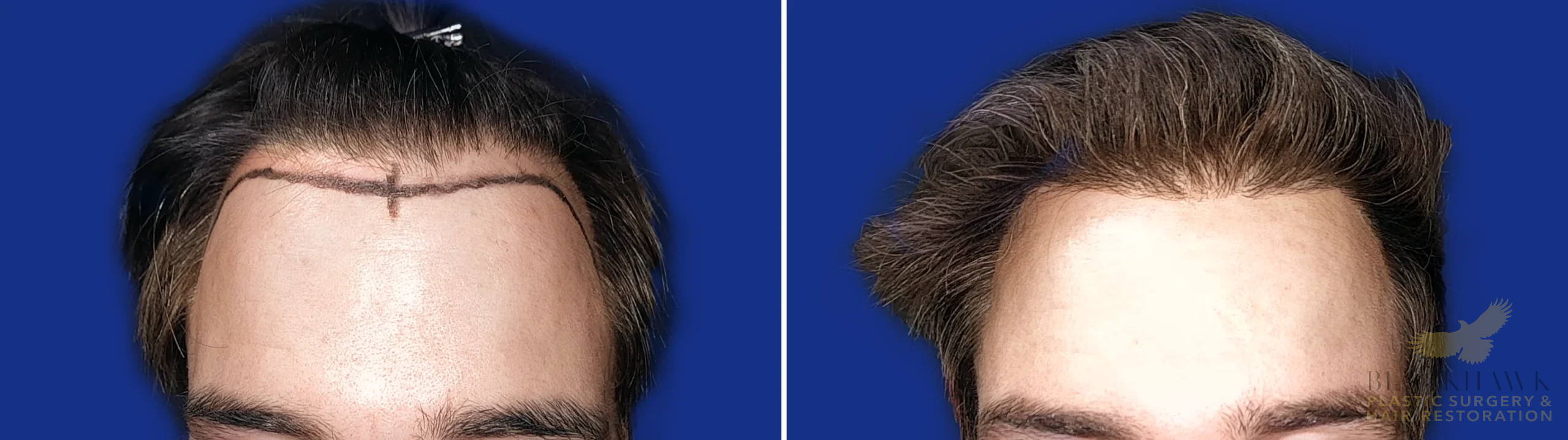 View • Before | After