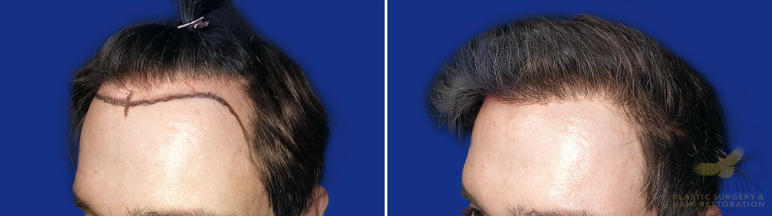 View • Before | After