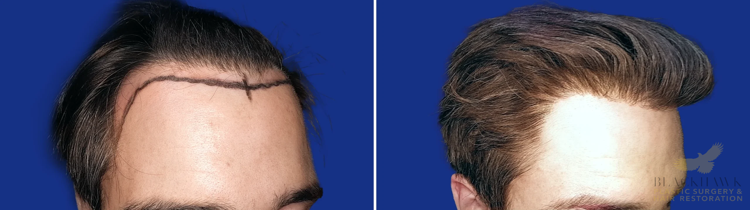 View • Before | After