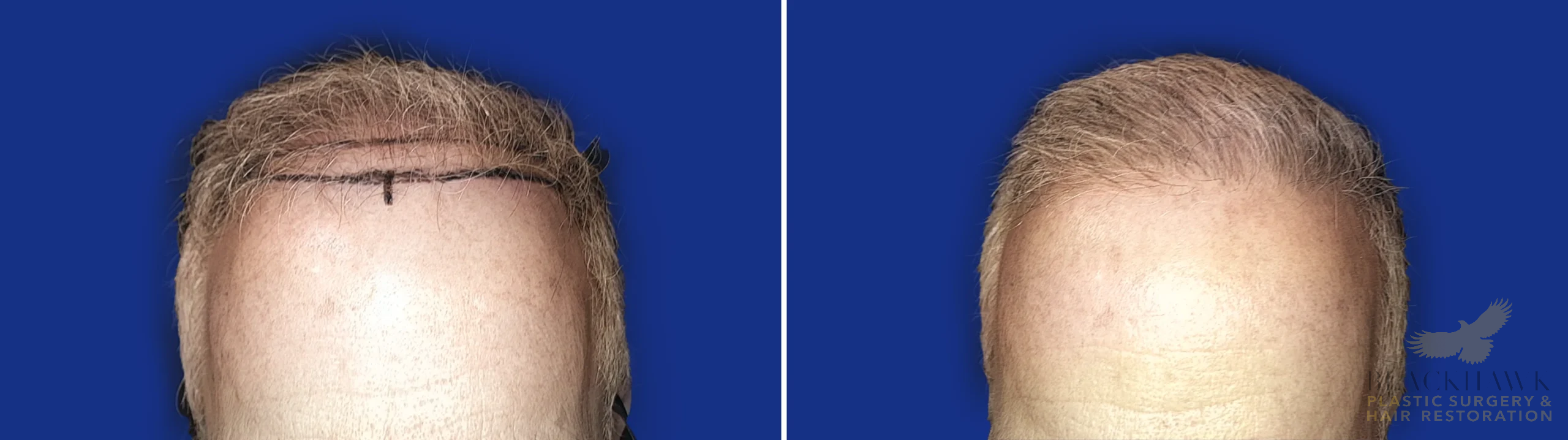 View • Before | After