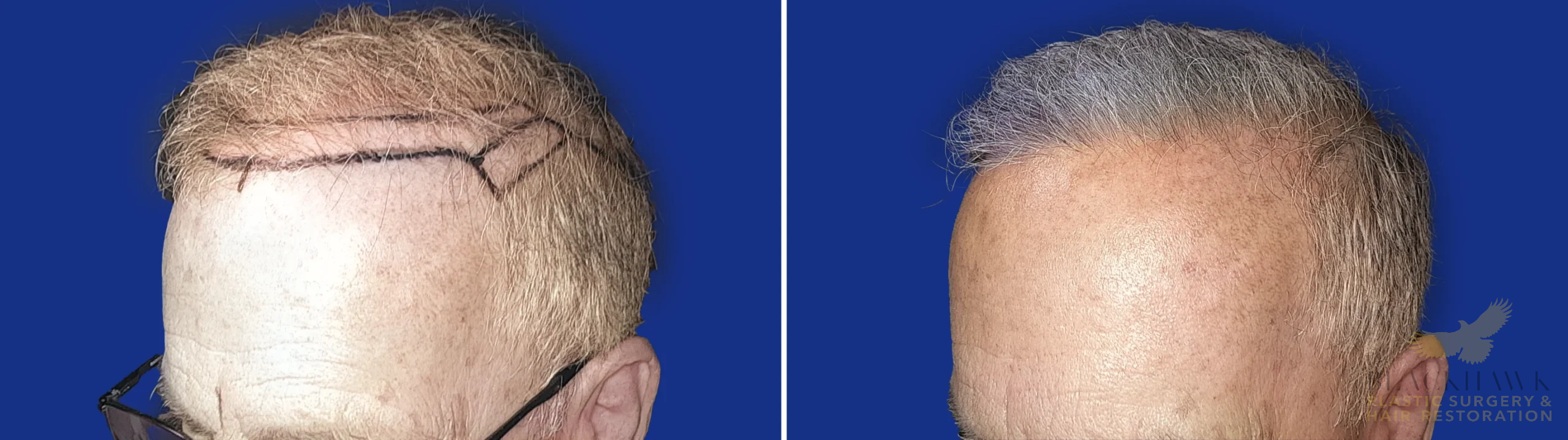 View • Before | After