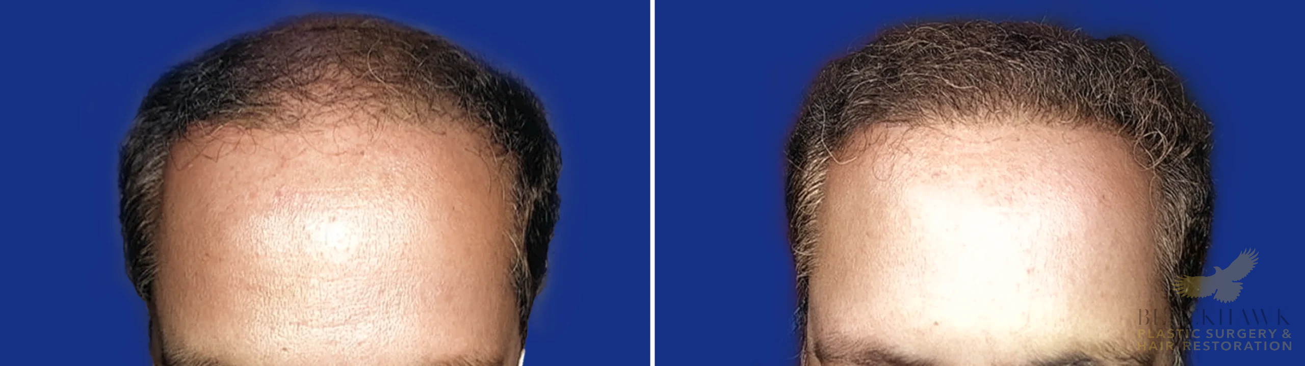 View • Before | After