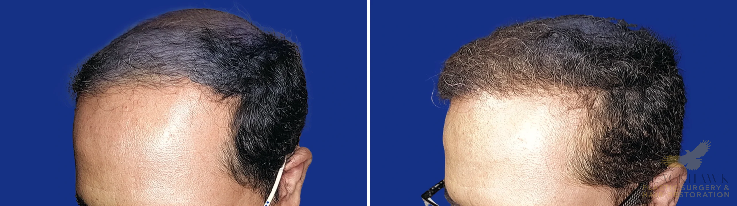 View • Before | After