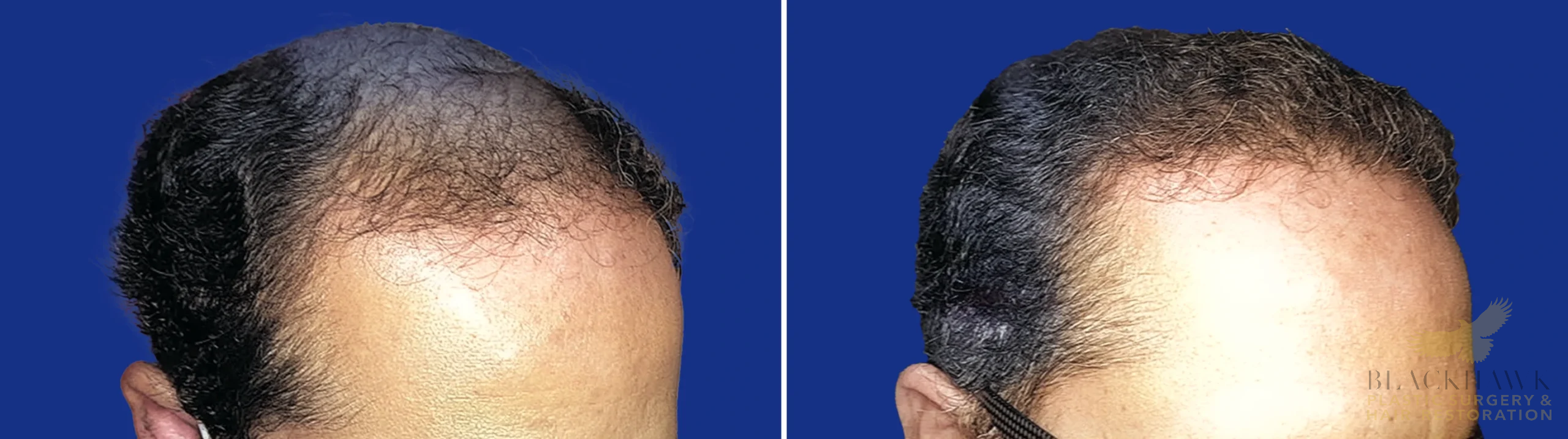 View • Before | After