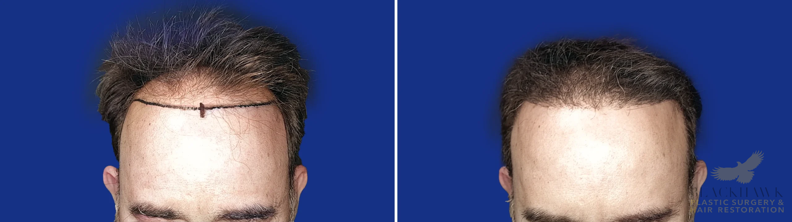 View • Before | After