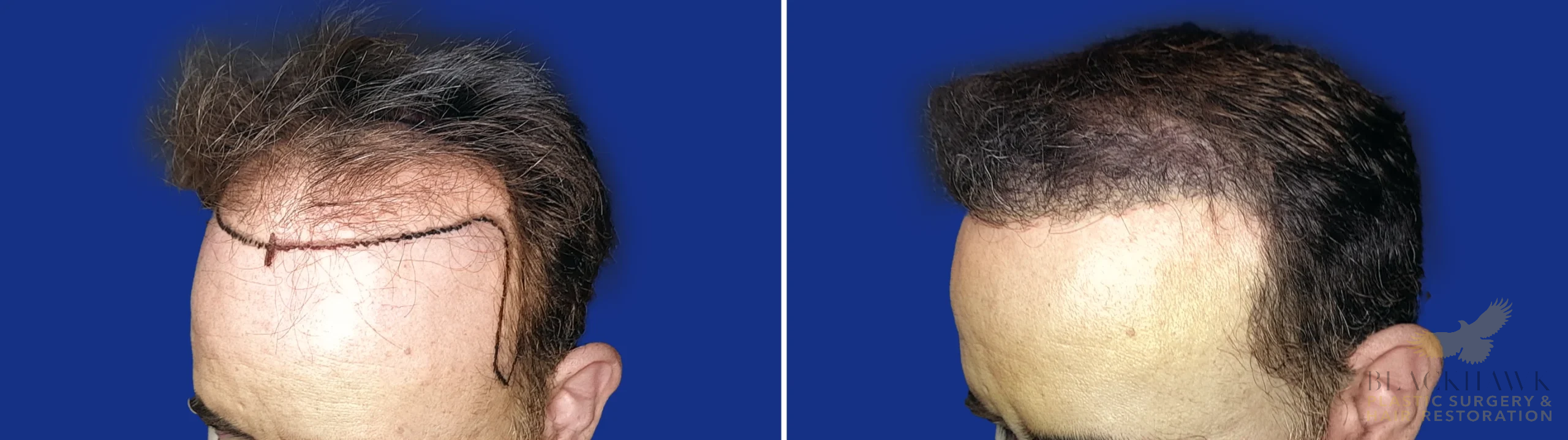 View • Before | After