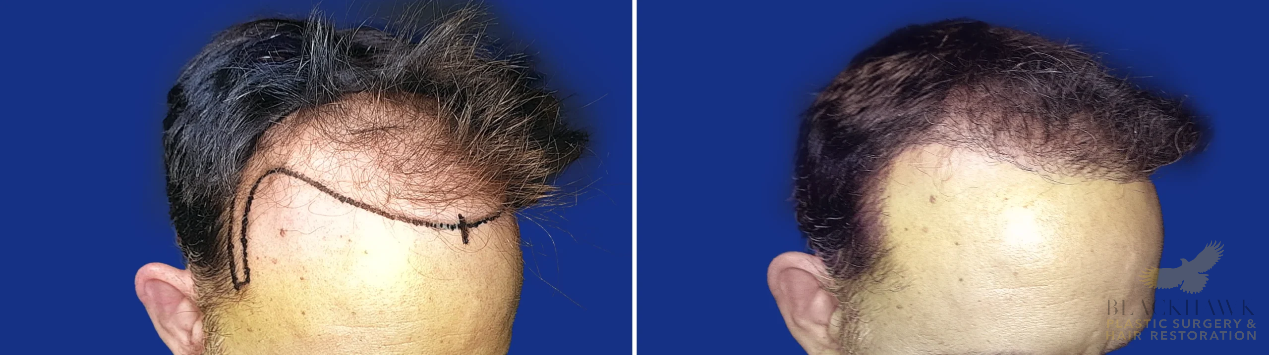 View • Before | After