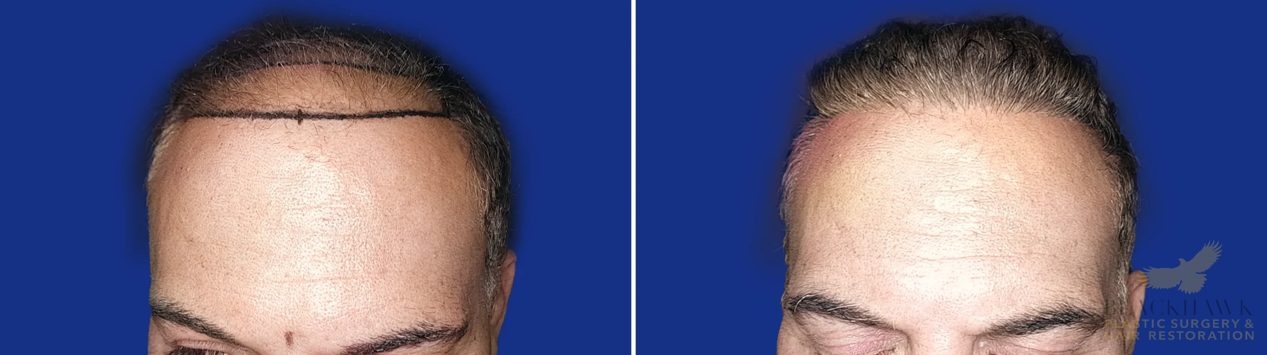 View • Before | After