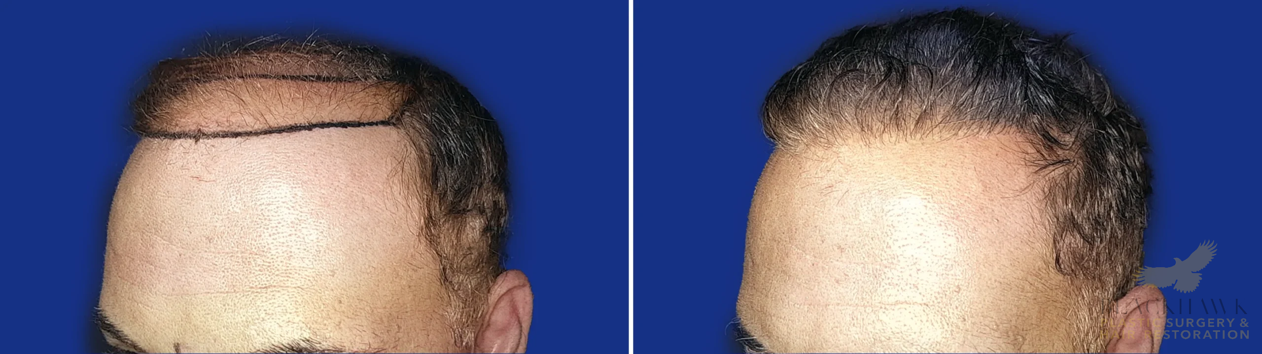 View • Before | After