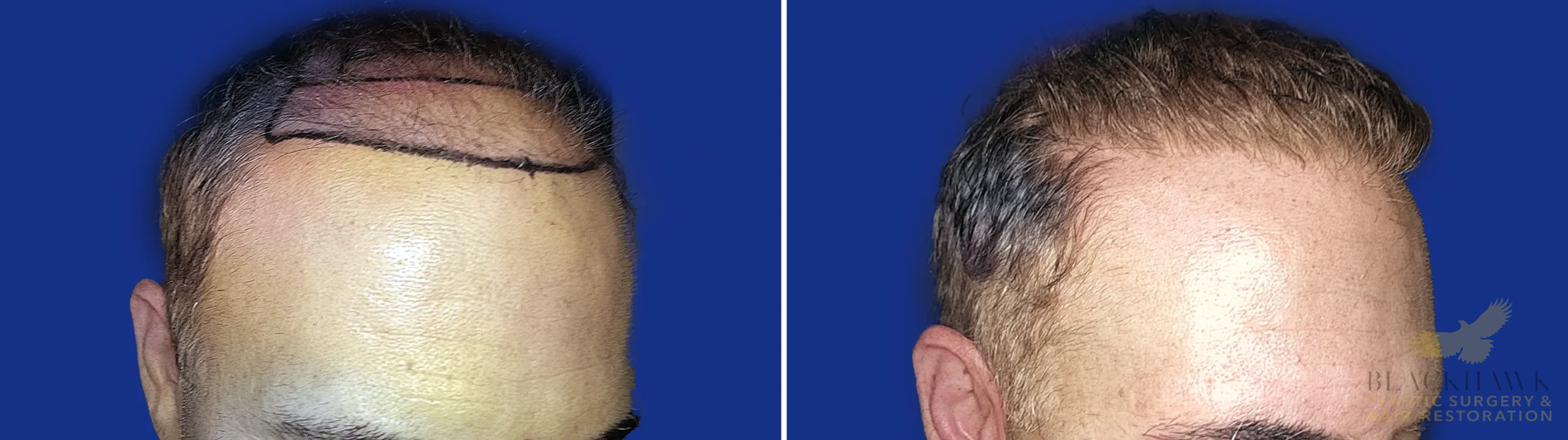 View • Before | After