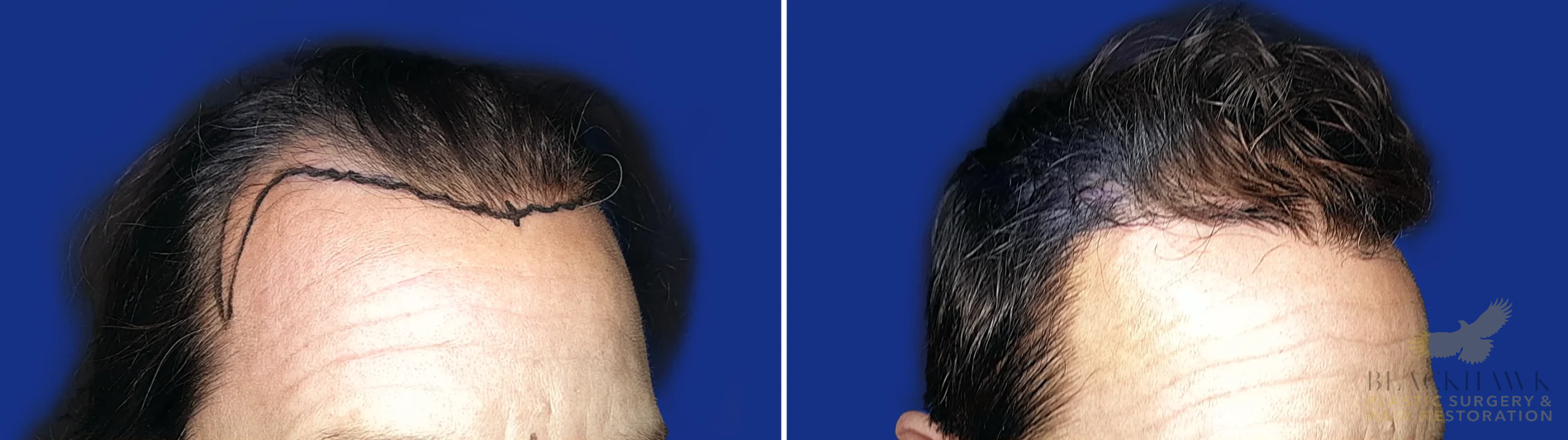 View • Before | After