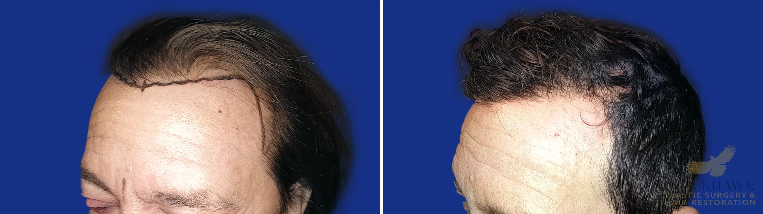 View • Before | After