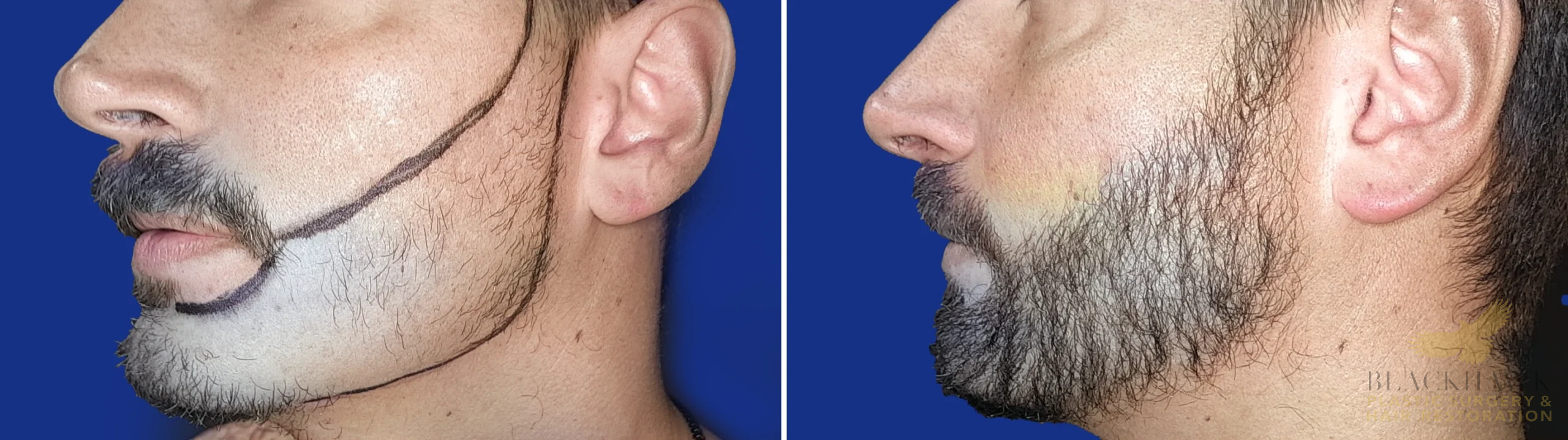 View • Before | After