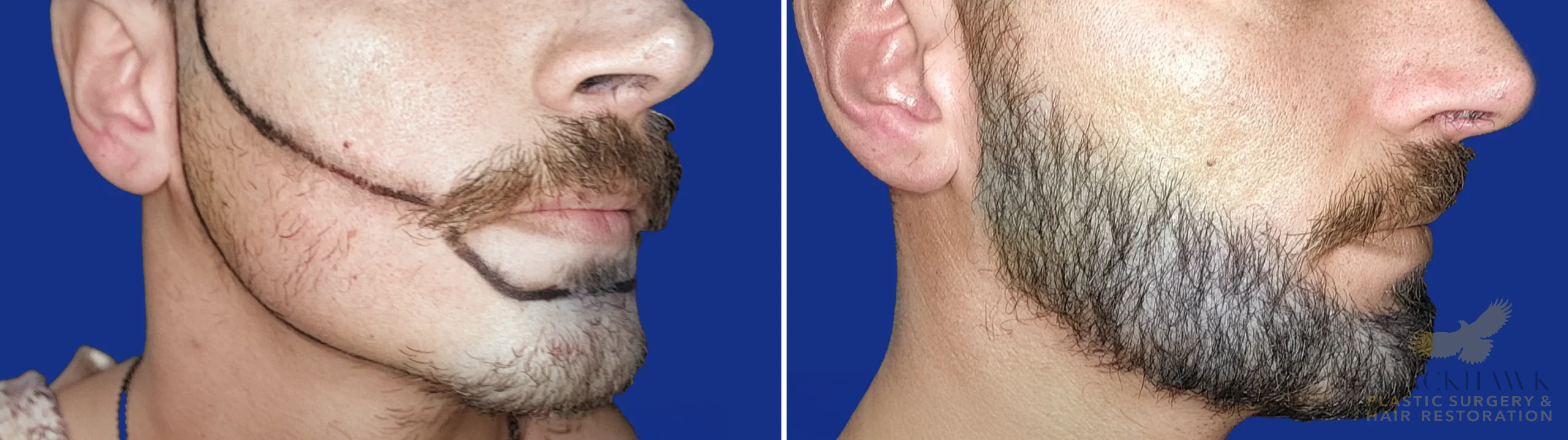 View • Before | After