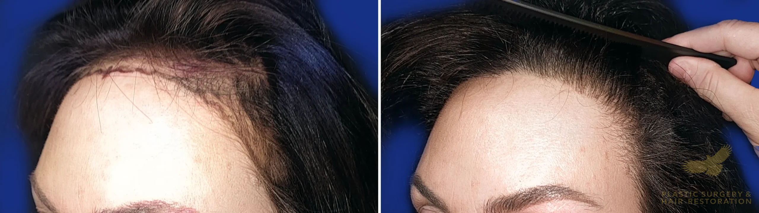 View • Before | After