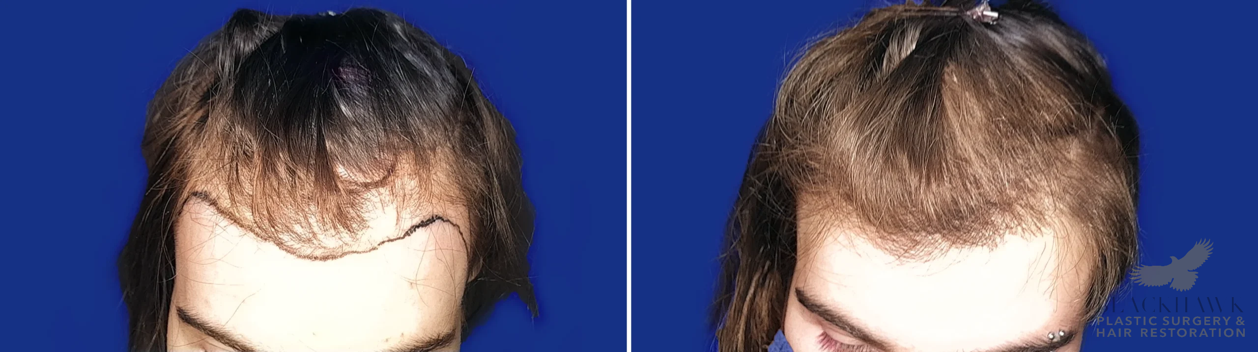 View • Before | After