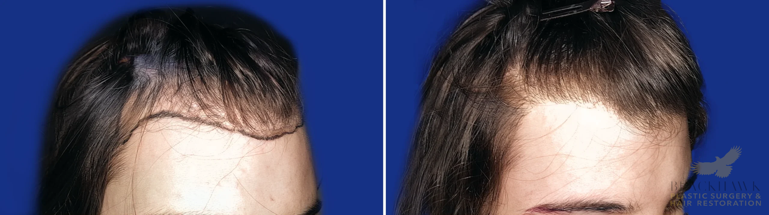 View • Before | After