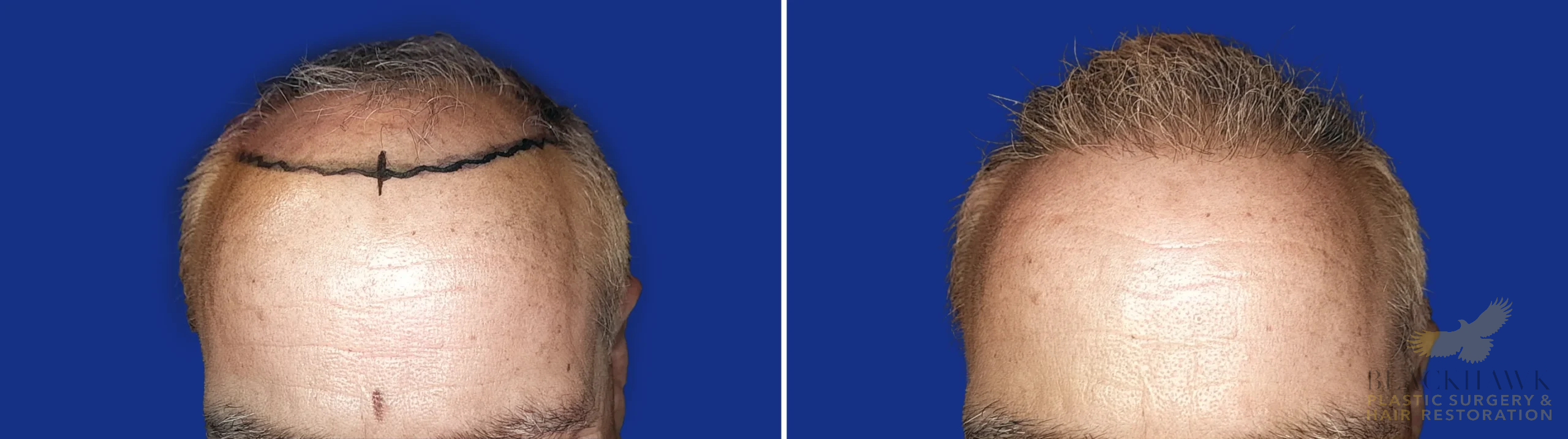 View • Before | After