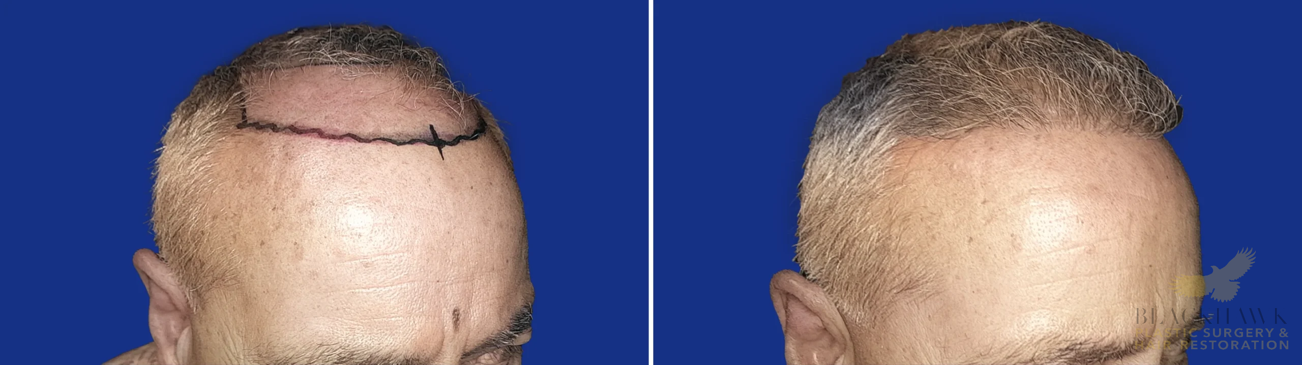 View • Before | After