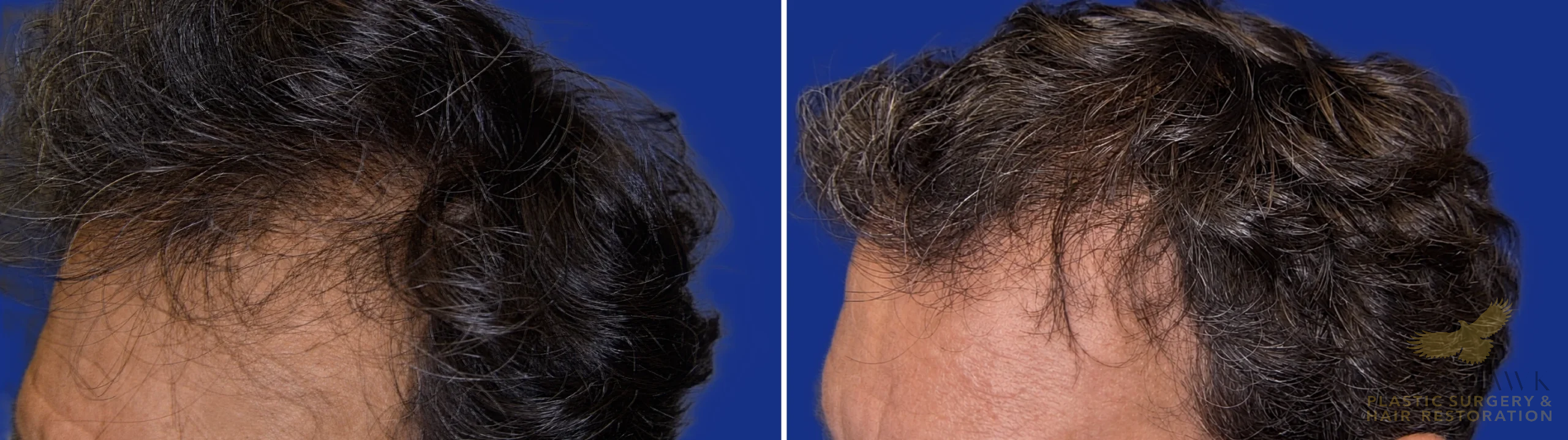 View • Before | After