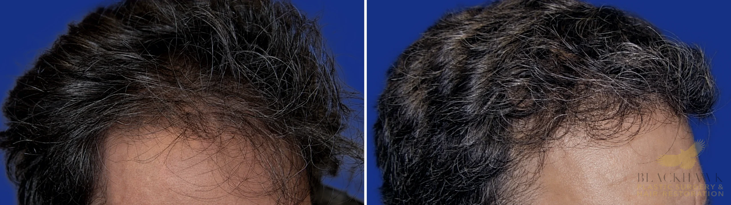 View • Before | After
