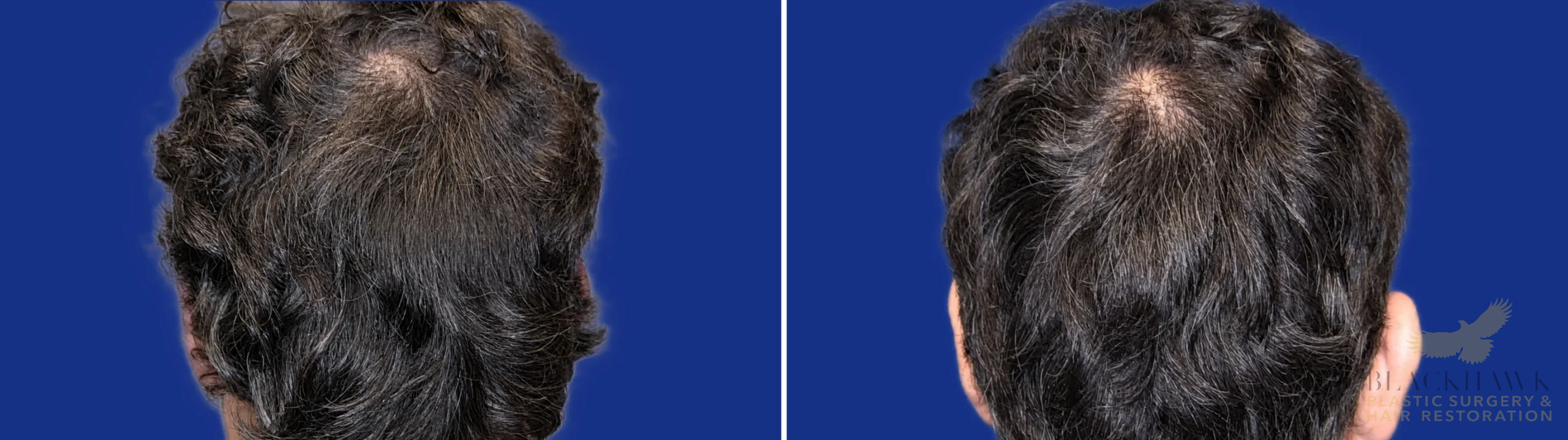 View • Before | After