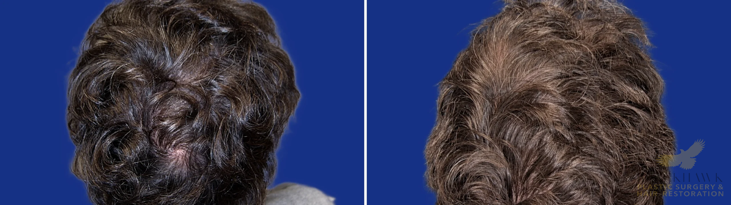 View • Before | After