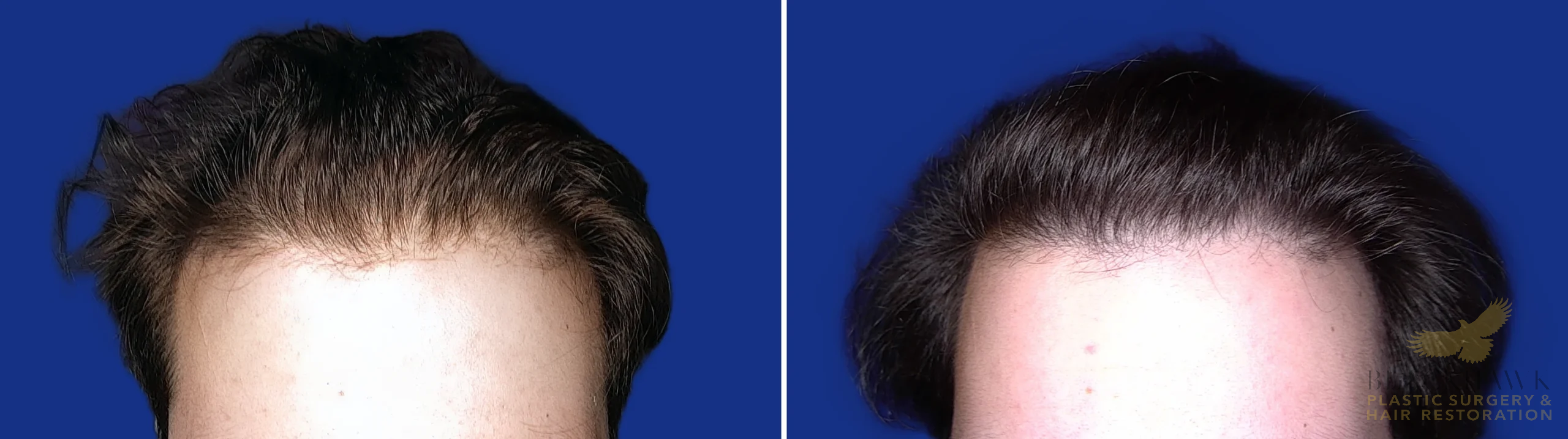 View • Before | After