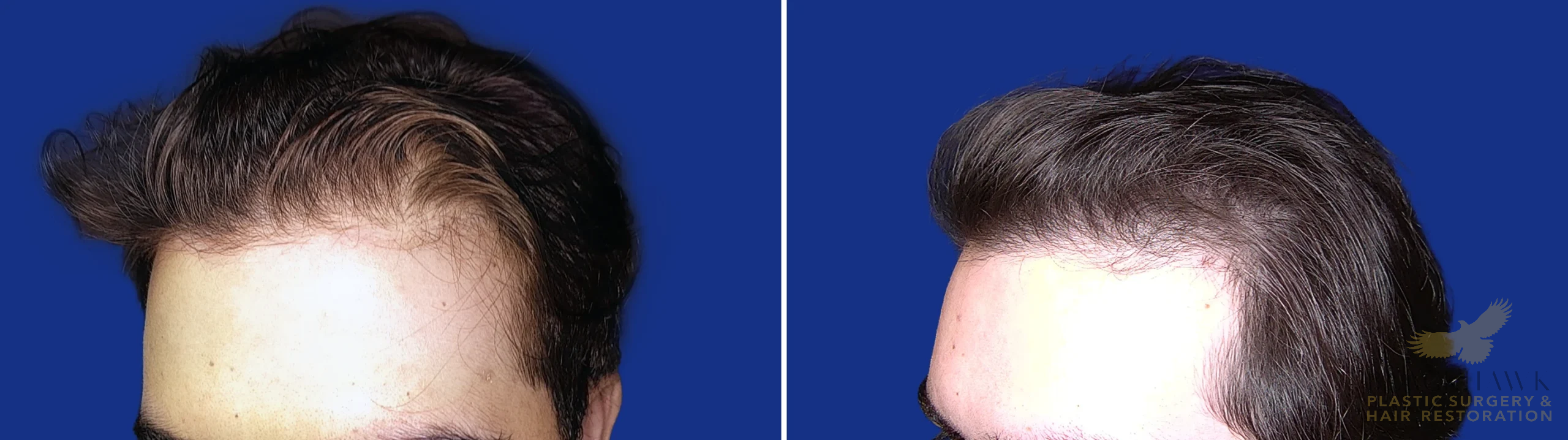 View • Before | After