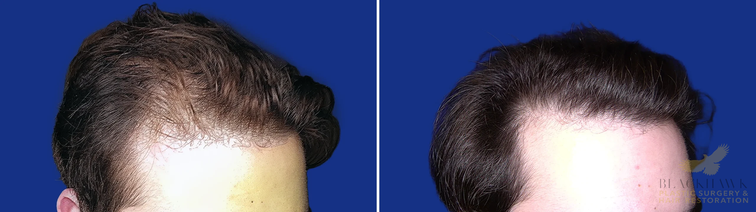 View • Before | After